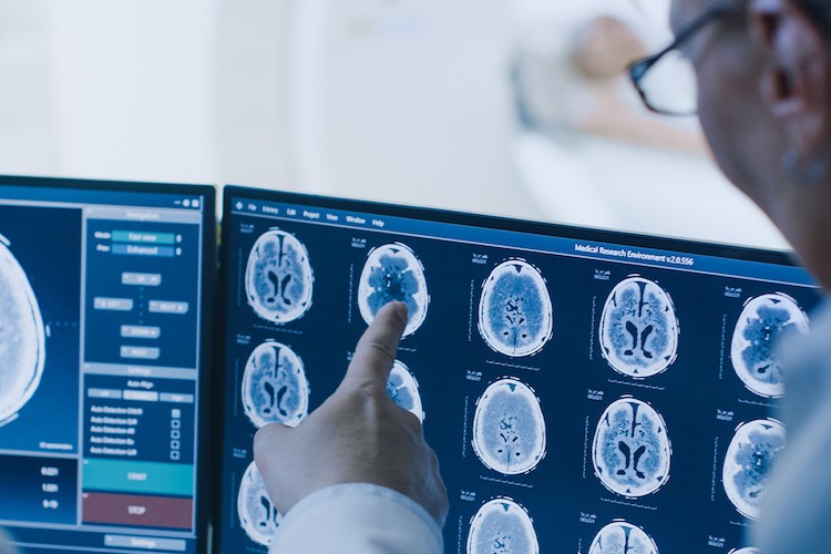 Brain Scans Brain Scans